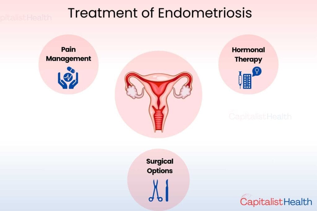 Capitalist Health - Capitalist Health - Treatment - Endometriosis Symptoms and Treatment Options