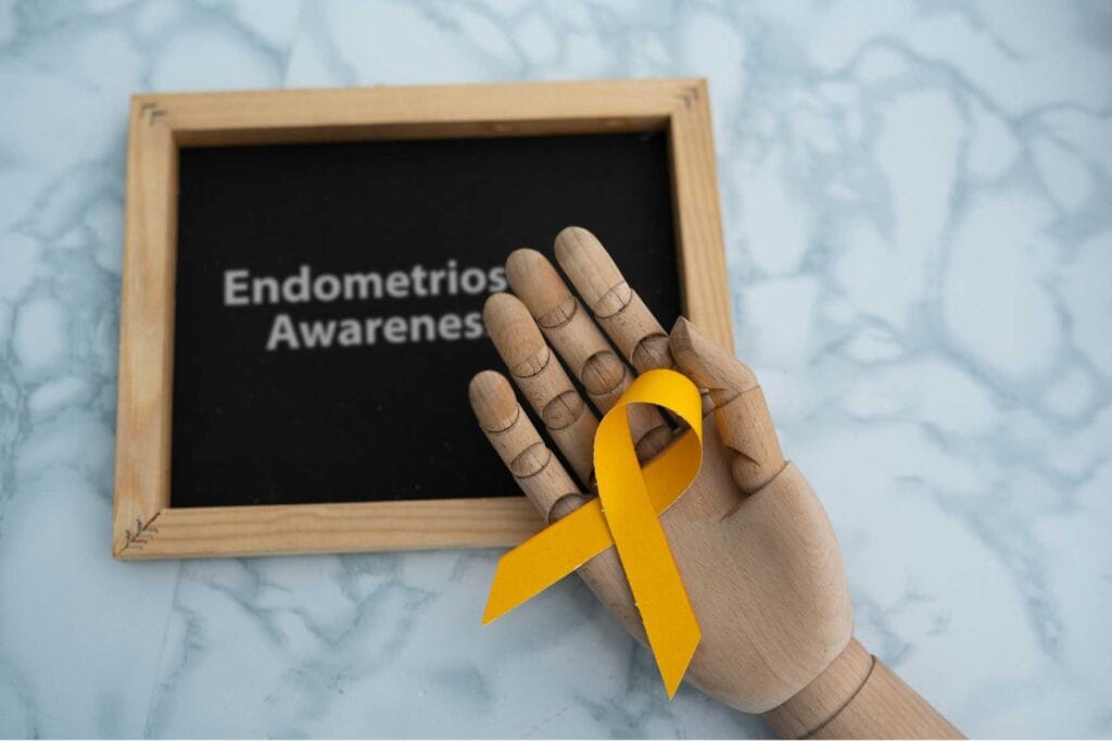 Capitalist Health - What Is Endometriosis - Endometriosis Symptoms and Treatment Options